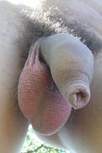 dick09
